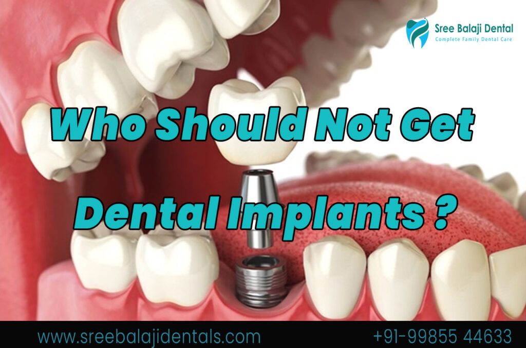 Dental Implants In Hyderabad