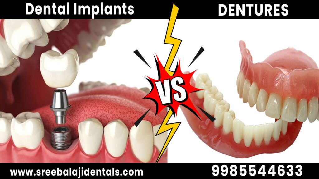 Are Dental implants Better than Dentures?