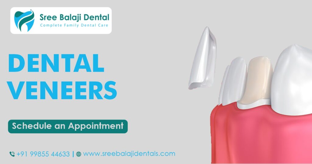 Dental Veneers In Hyderabad