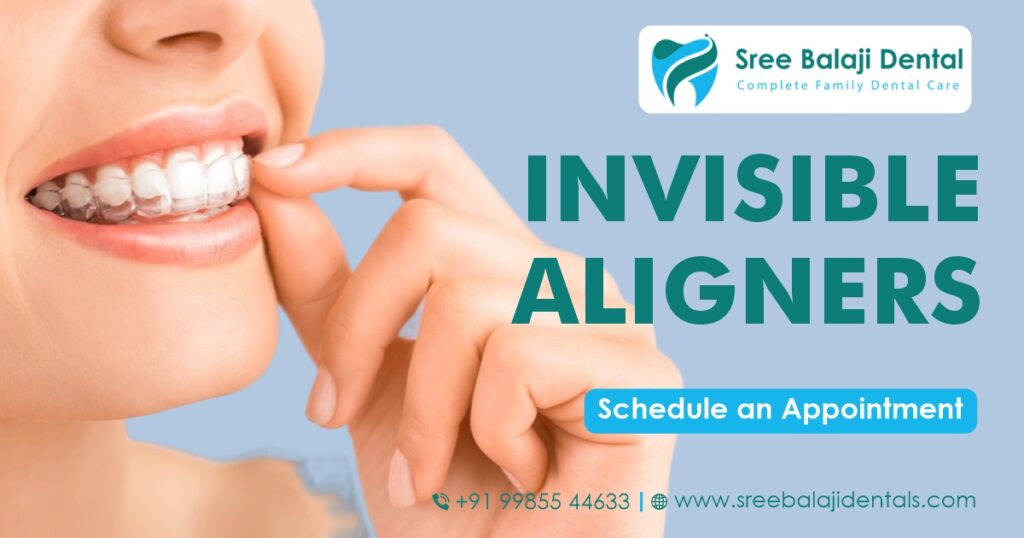 Invisible Aligners In Hyderabad