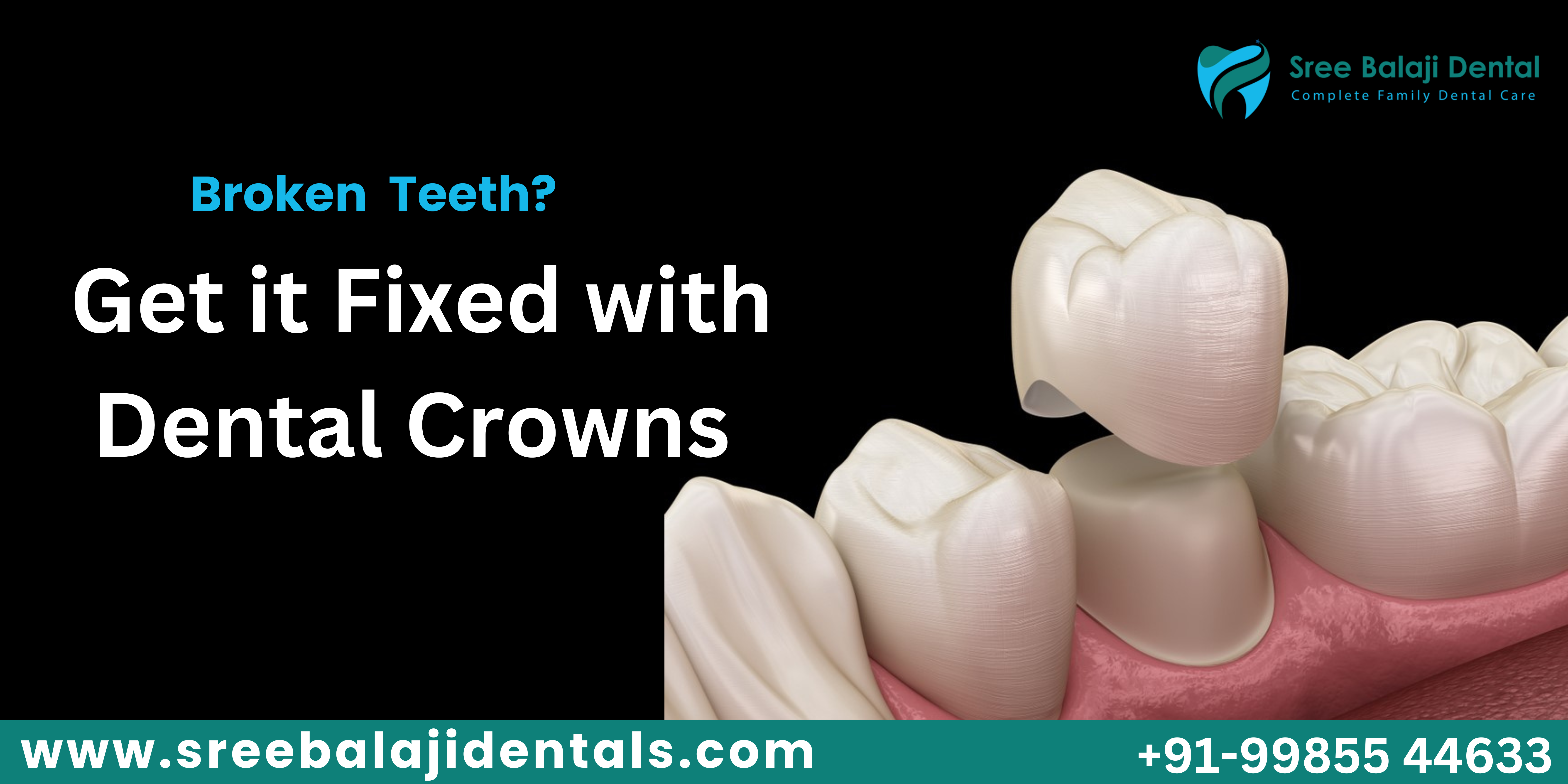 Dental Crowns in Hyderabad