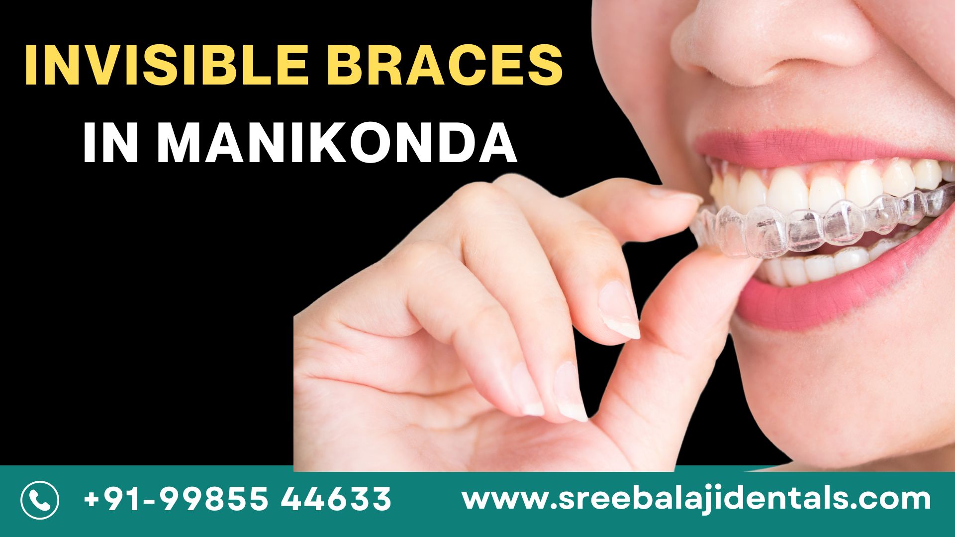Invisible Braces In Manikonda