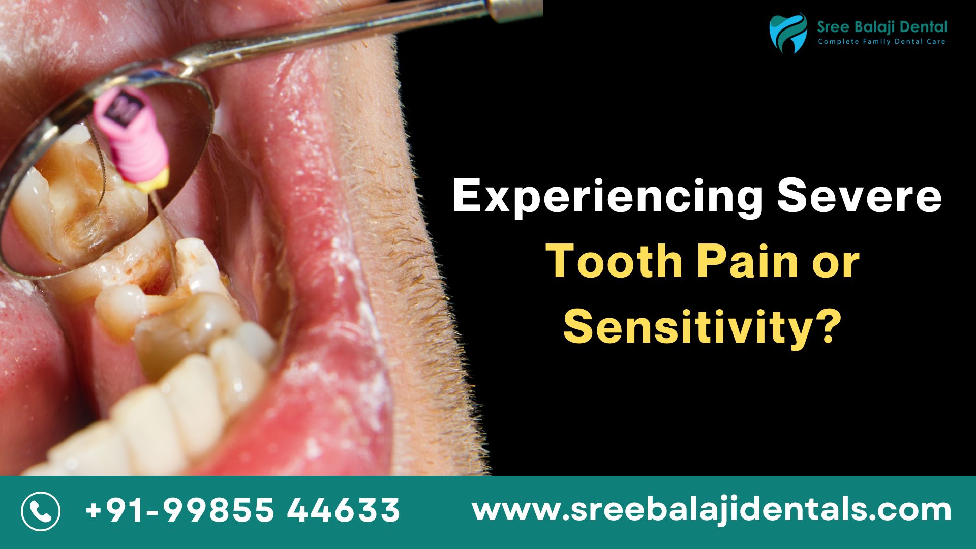 Root Canal Treatment In Manikonda