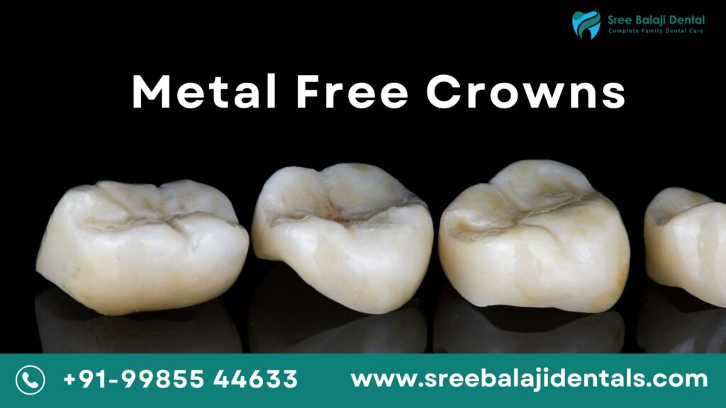 Metal Free Crowns in Manikonda