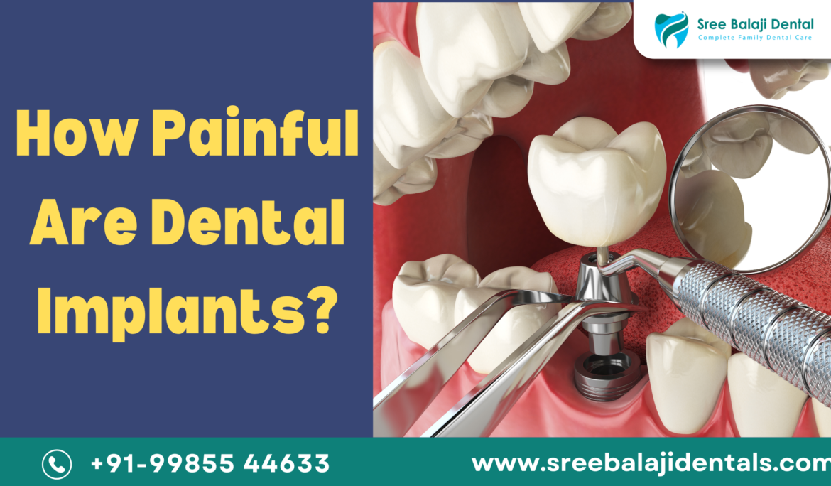 How Painful Are Dental Implants
