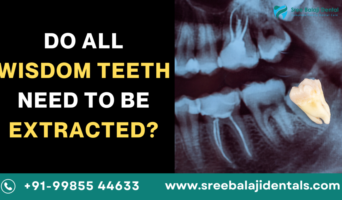 Wisdom teeth extraction In Manikonda