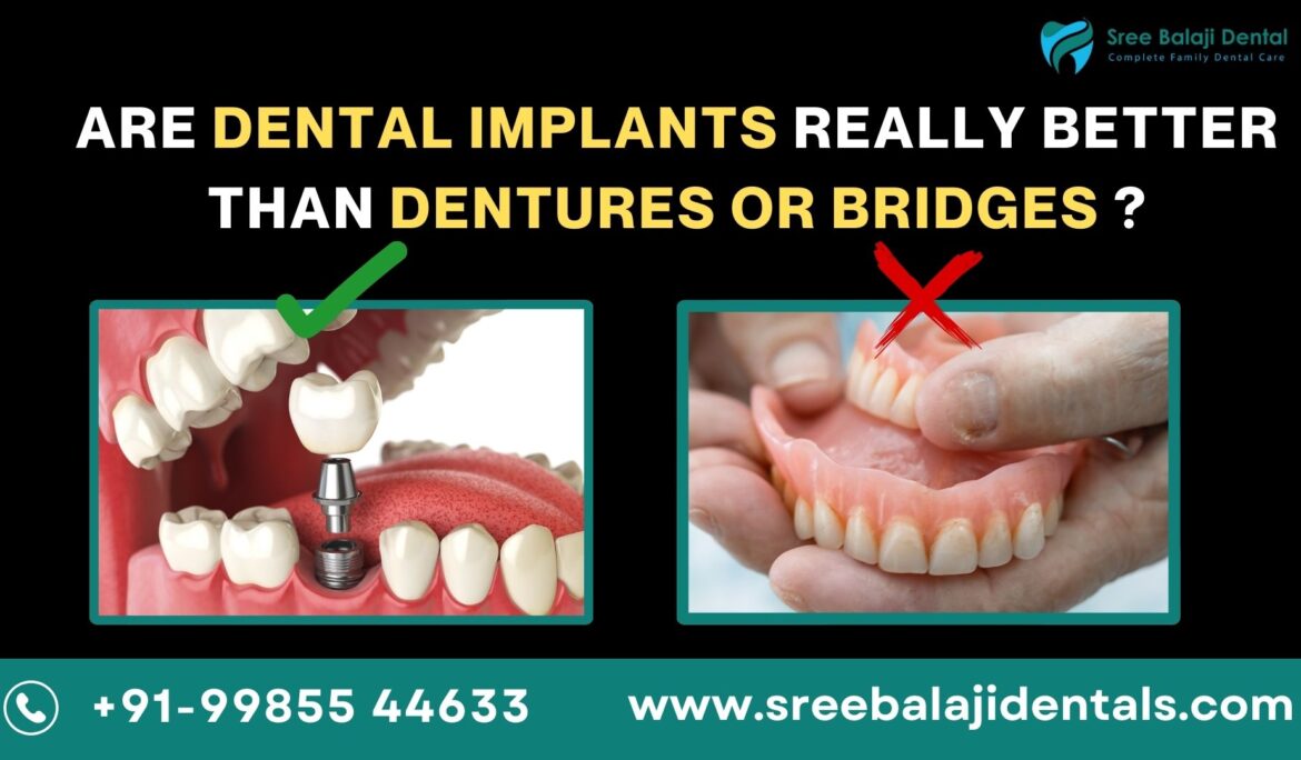 Dental Implants in Manikonda
