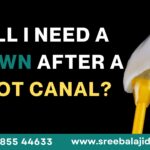 Will I Need a Crown After a Root Canal?