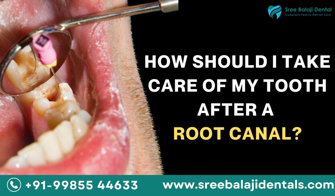 How Should I Take Care of My Tooth After a Root Canal?