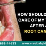 How Should I Take Care of My Tooth After a Root Canal?